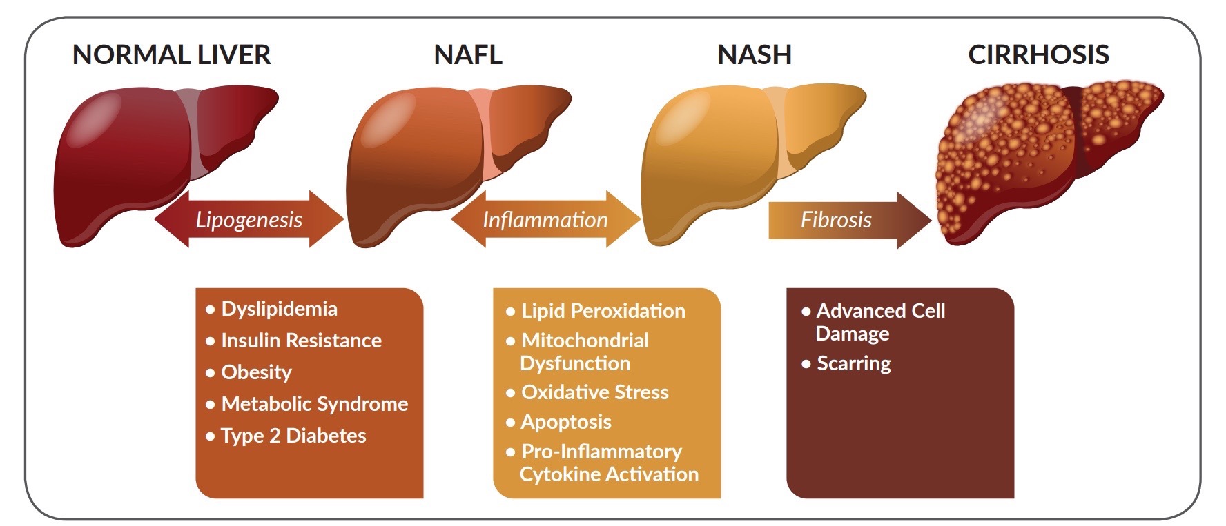 Blog | Nonalcoholic fatty liver disease | AstonRX